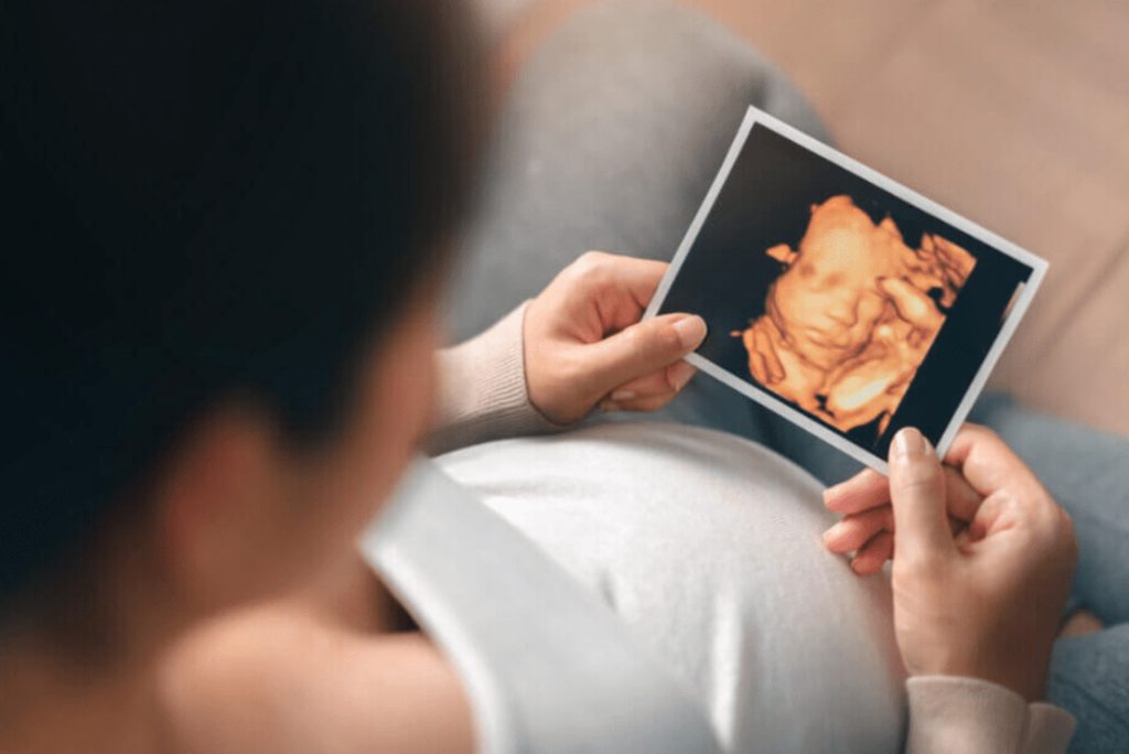 Best Time To Do 4D Ultrasound